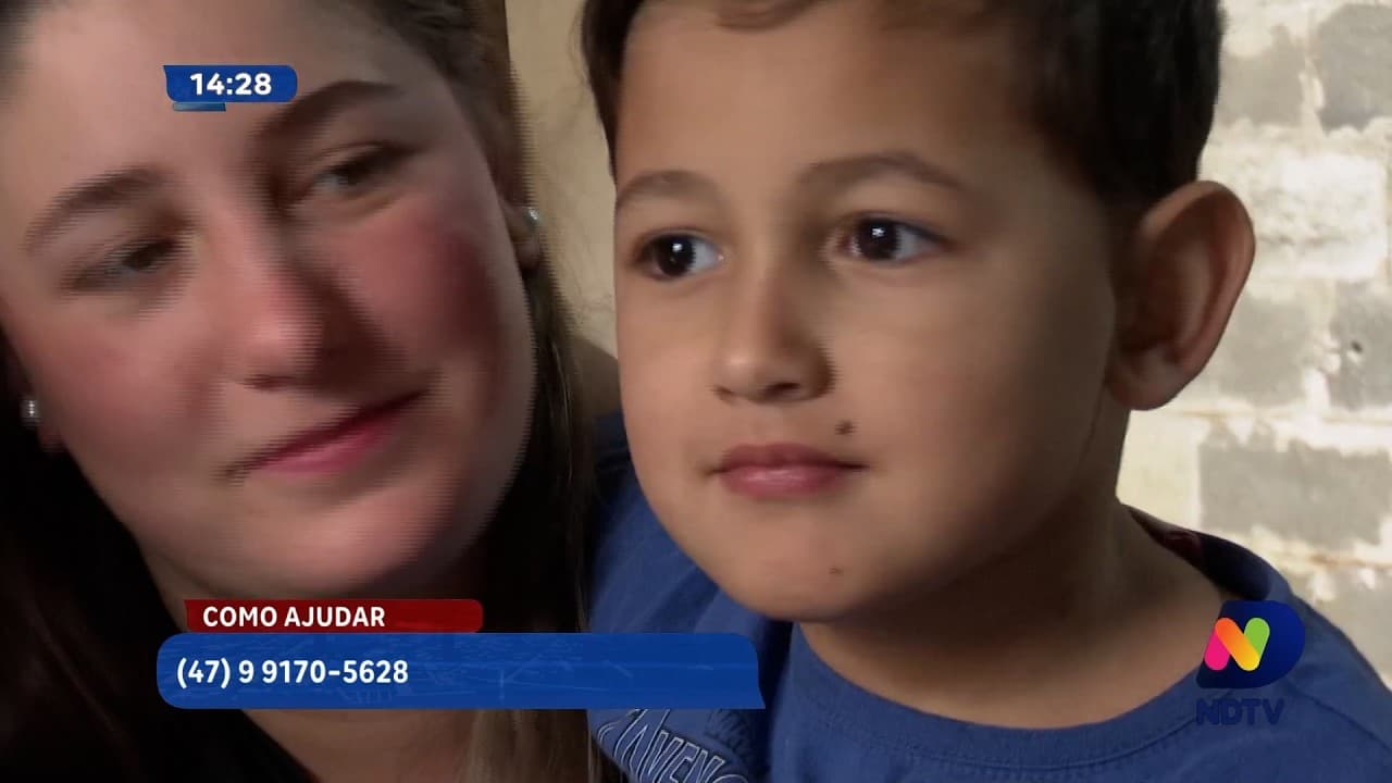 Jovem relata espera de dois anos por cirurgia na Saúde em Itajaí