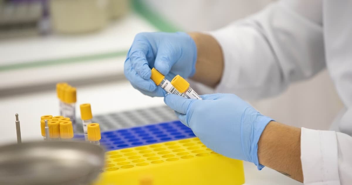 Saiba quando começa o mutirão para realização de exames laboratoriais em Brusque - O Município