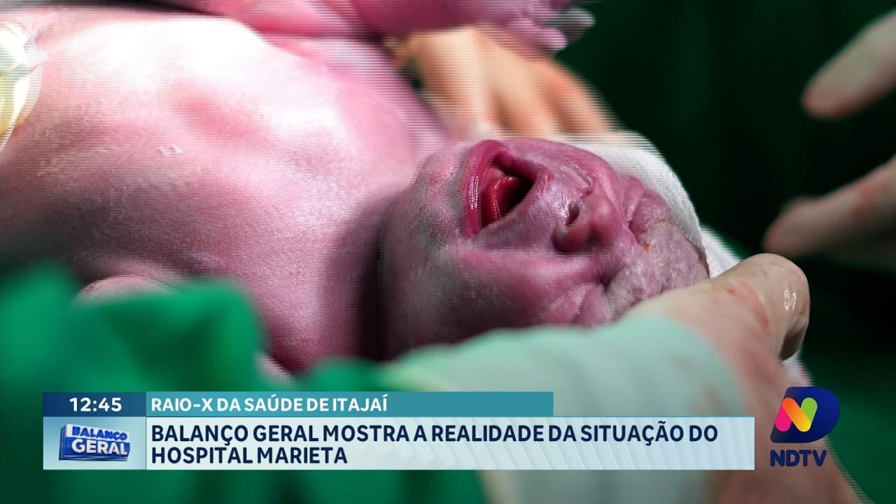 Balanço Geral expõe situação atual do Hospital Marieta em Itajaí