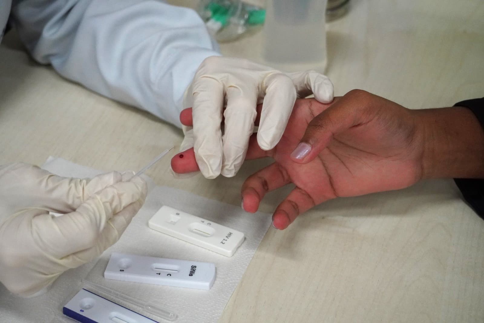 Lages Amplia Atendimento para Testes Rápidos e Vacinação Contra Hepatite B em Ação do Julho Amarelo